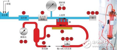 血液透析機(jī)要求極其精確地測(cè)量患者血壓和透析液（清除血流中的毒素）壓力